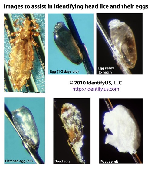 head lice life stages