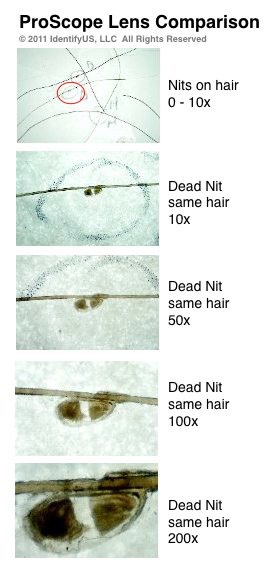 ProScope lens comparison on head lice