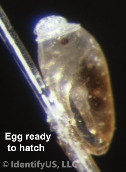 Head louse - ready to hatch egg