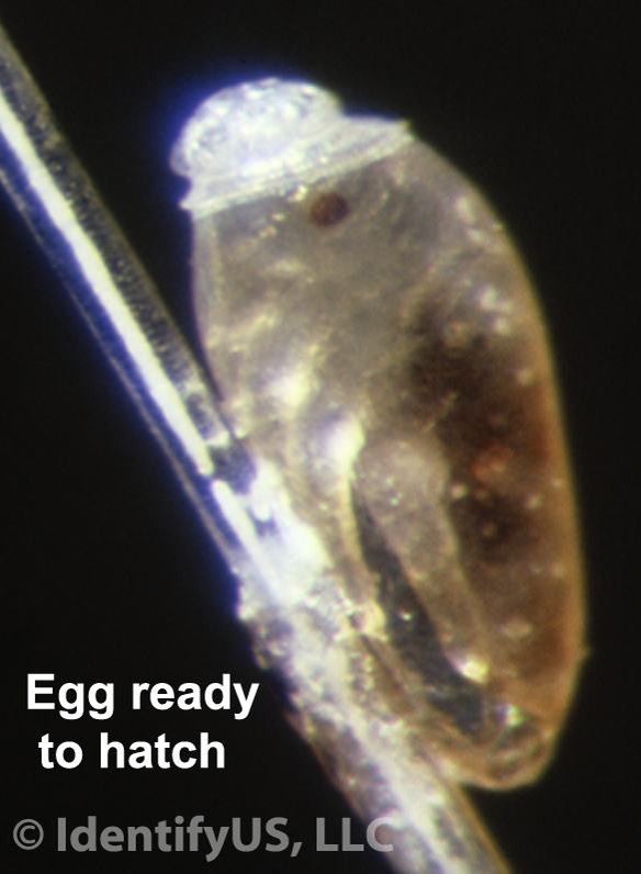 head louse egg ready to hatch